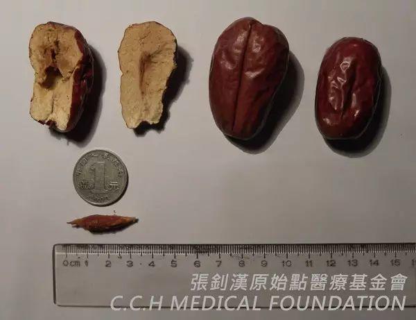 枣核划伤食道,难以吞咽案例 枣核划伤食道,难以吞咽案例